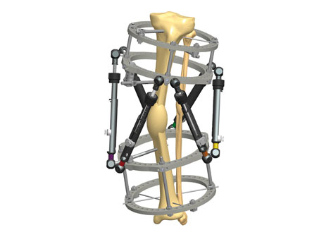 2012 11 15 Orthofix THEXFig29a WEB